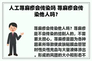 人工荨麻疹会传染吗 荨麻疹会传染他人吗？