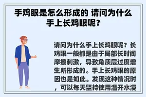 手鸡眼是怎么形成的 请问为什么手上长鸡眼呢？