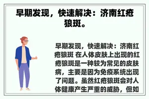 早期发现，快速解决：济南红疮狼斑。