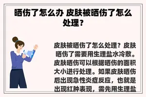 晒伤了怎么办 皮肤被晒伤了怎么处理？