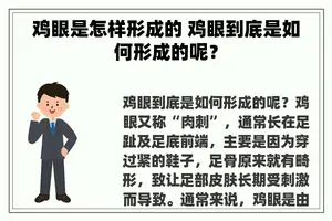 鸡眼是怎样形成的 鸡眼到底是如何形成的呢？