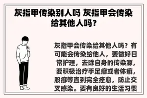 灰指甲传染别人吗 灰指甲会传染给其他人吗？