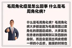 毛周角化症是怎么回事 什么是毛周角化病？