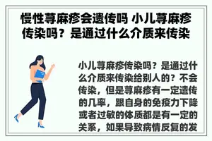 慢性荨麻疹会遗传吗 小儿荨麻疹传染吗？是通过什么介质来传染给别人的？