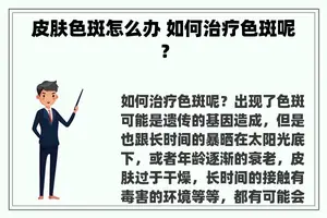 皮肤色斑怎么办 如何治疗色斑呢？