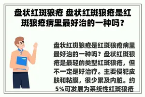 盘状红斑狼疮 盘状红斑狼疮是红斑狼疮病里最好治的一种吗？